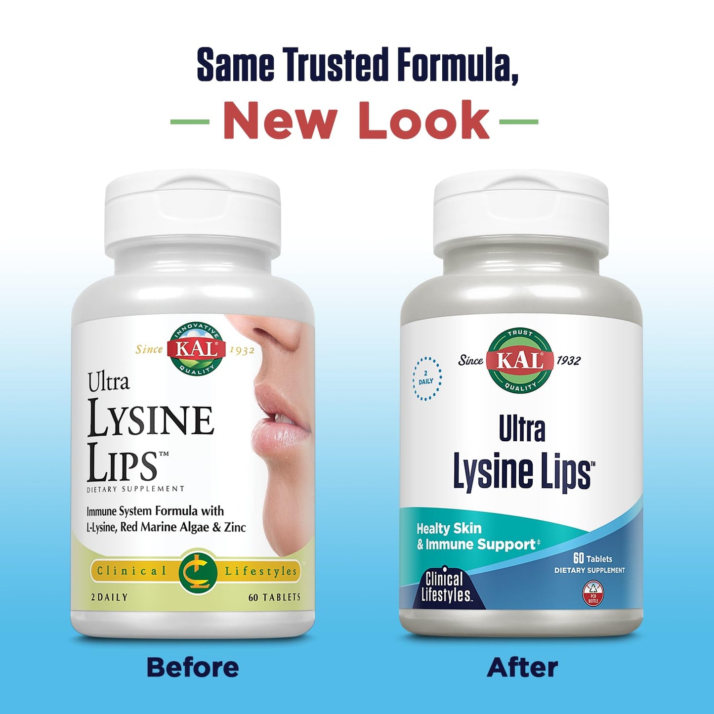 KAL Ultra Lysine Lips Supplement Tablets, 60 Tablets