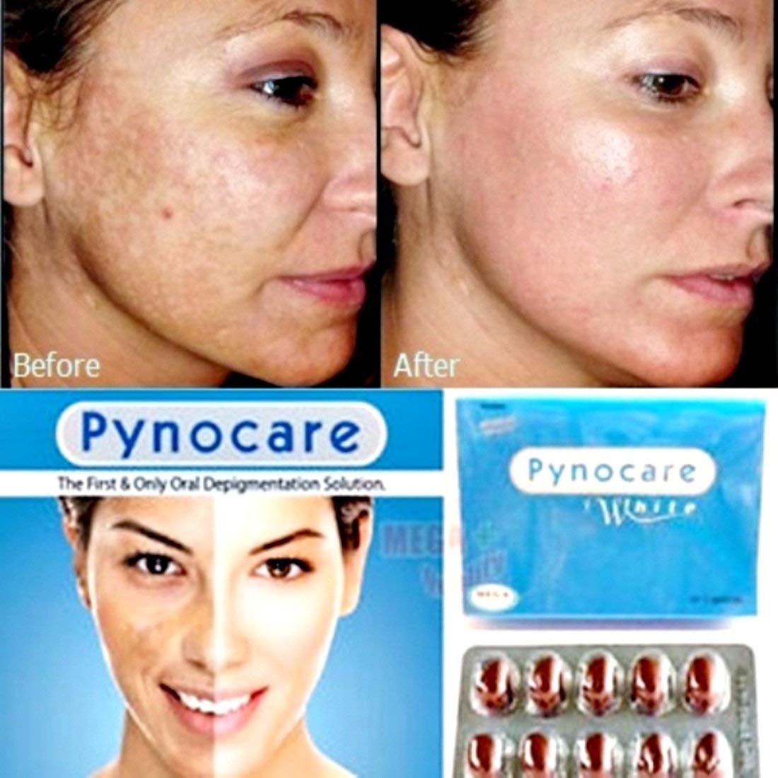 Mega Brands Pynocare White Treatment of Melasma 20 Capsules