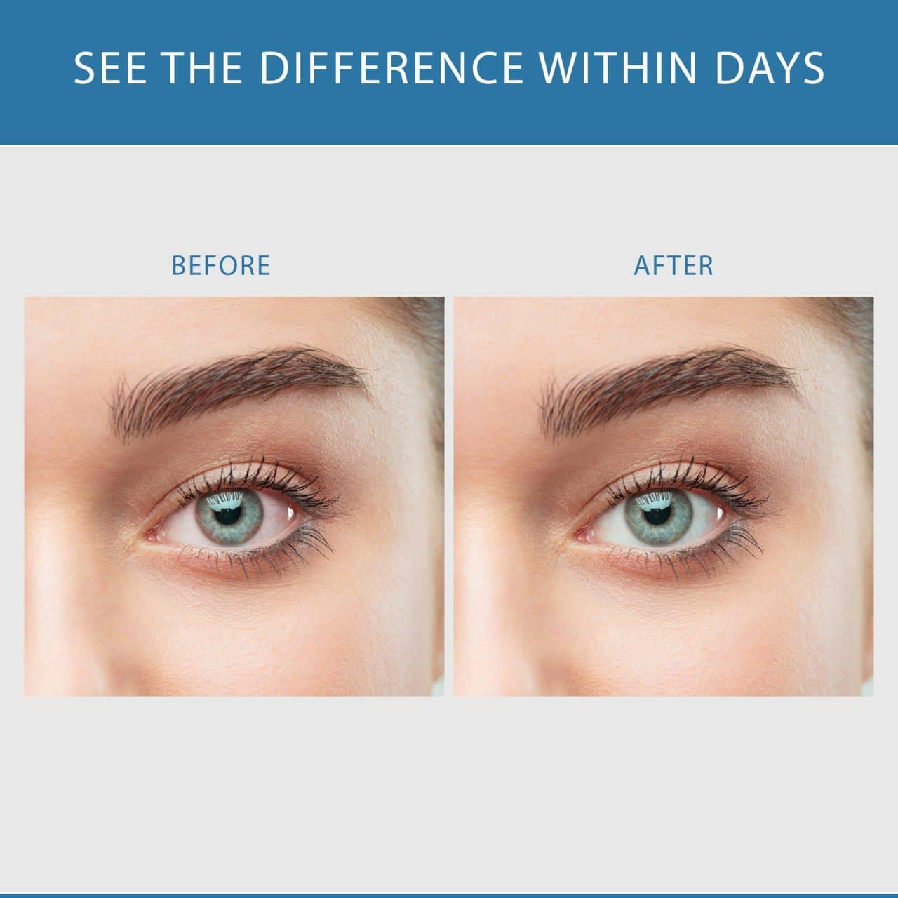 Success Chemistry Sclera White Eye Brightening Formula Capsule, 60 Veggie Capsules
