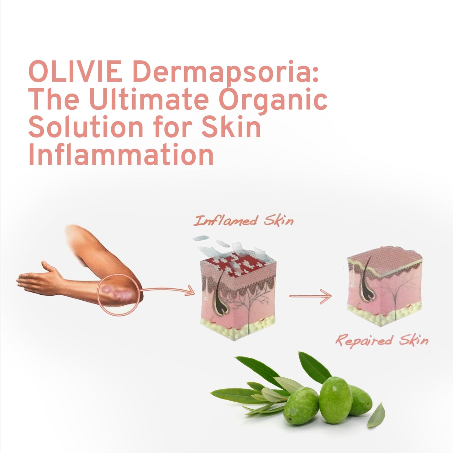 OLIVIE LES BIENFAITS DE L'OLIVIER DERMAPSORIA Organic Olive Leaf Extract Skin Supplement Capsule 80