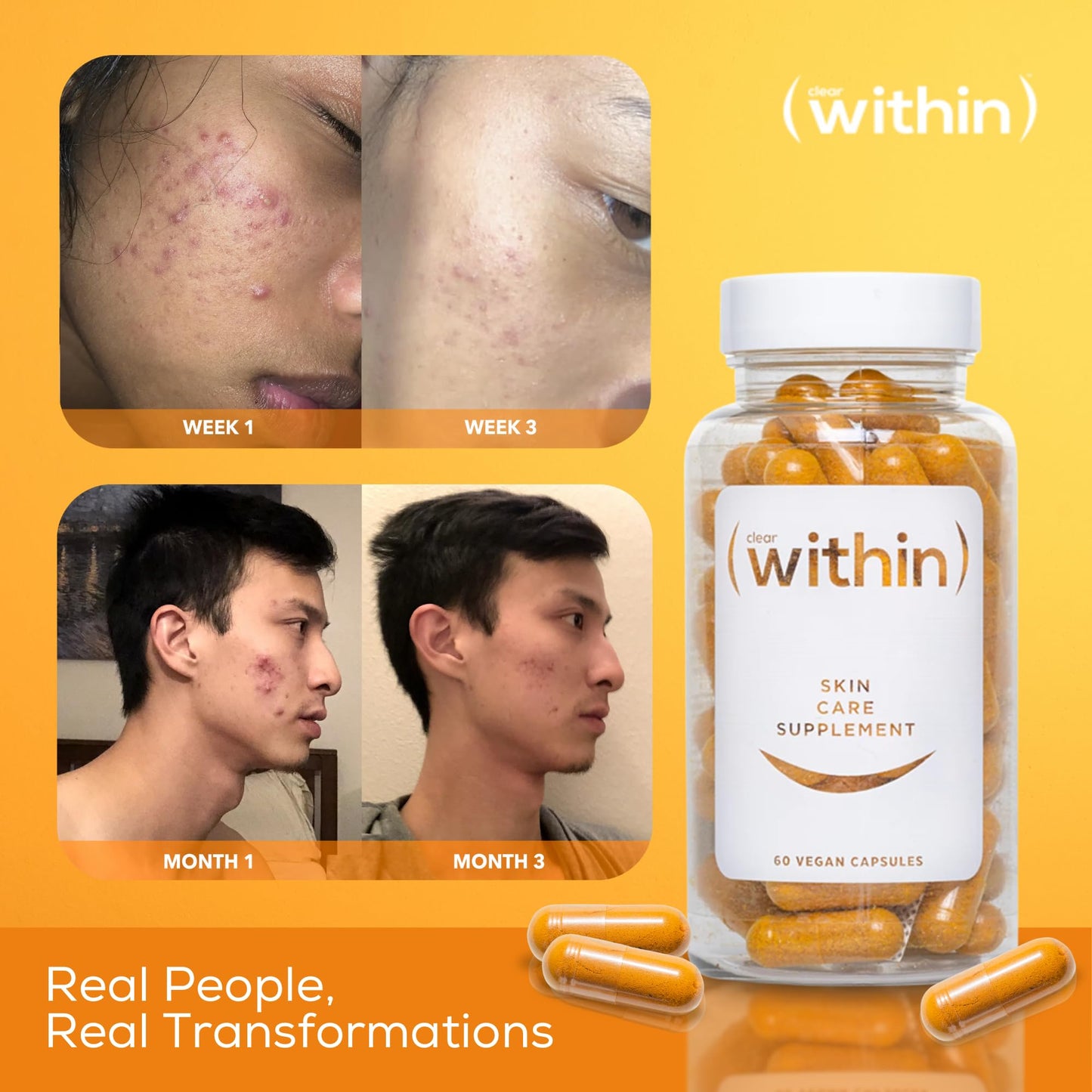 Clear Within Clear Skin Vitamin Capsules, 60 Count