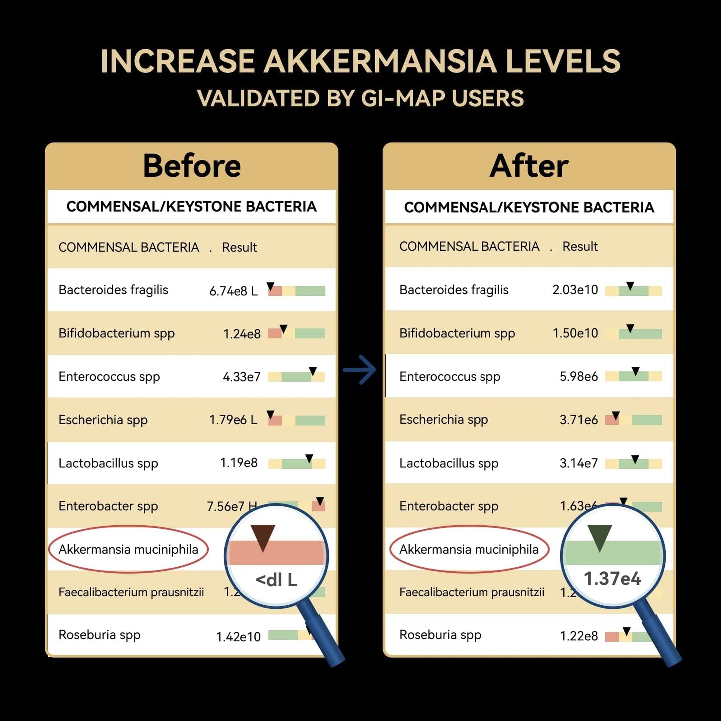 Inner Brightness Akkermansia Probiotic GLP-1 Supplement for Gut Health & Digestion, DigeSEB Digestive Enzymes & Vitamin B Complex - 30 Billion TFU, Third-Party Tested, 30 Capsules