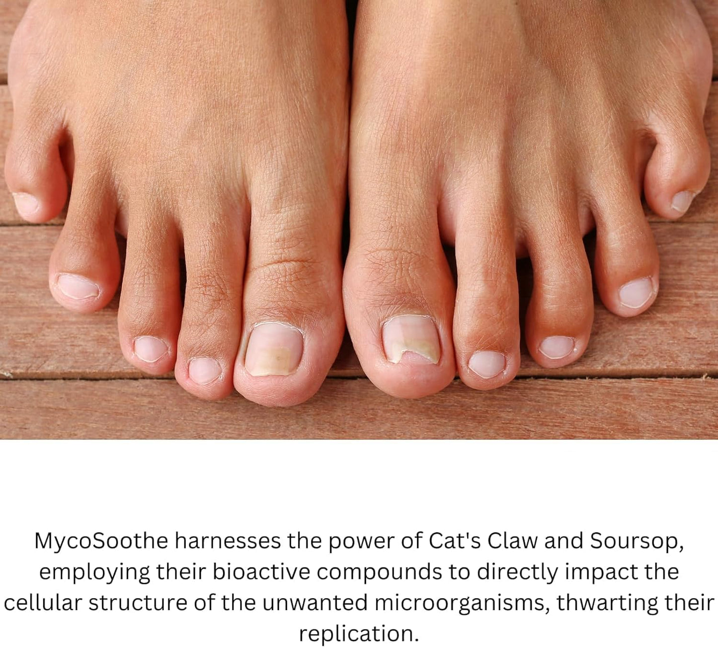Phytage Labs MycoSoothe Advanced Hair, Skin, Nail & Immunity Support Formula 60 Capsules