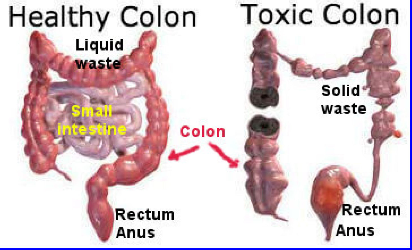 The One Minute Miracle Miracle Oxy-Colon Cleanse Capsule 1 Count