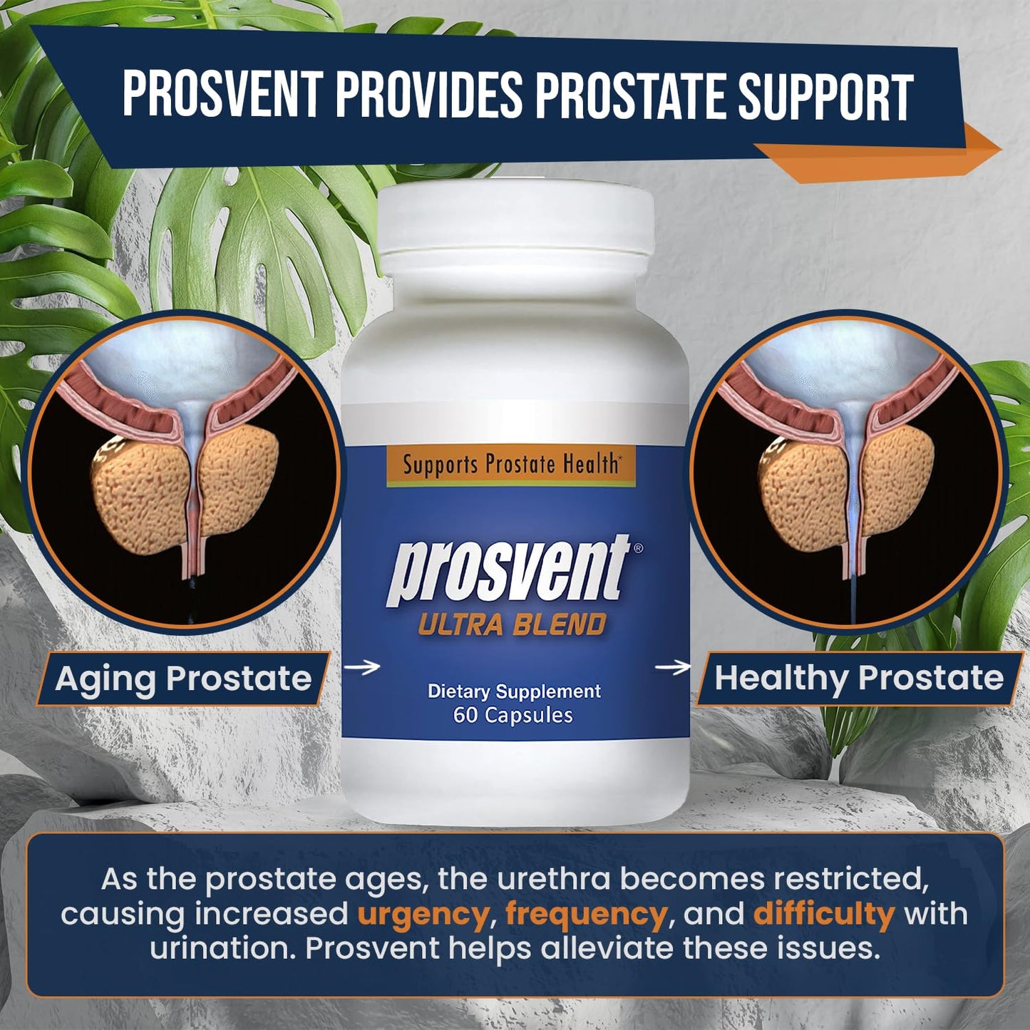 Prosvent Advanced Prostate Support Ultra Softgels 60