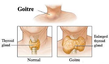 NaturalyPure GoiterX Capsule 90 Count