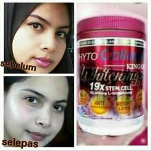 FSM Phyto Collagen Whitening 19X STEM CELL Anti-Aging Pro Whitening Results Energy Tablet, 1 Count