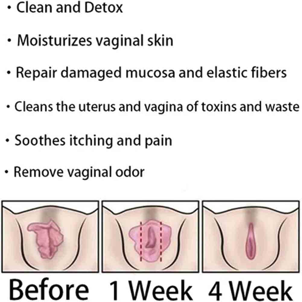 Weabet Instant Anti-Itch Detox Capsules, 11 Capsules