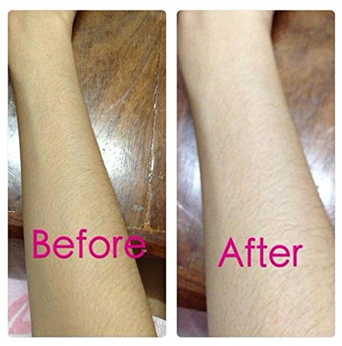Gluta Frosta PLUS 30 Capsules