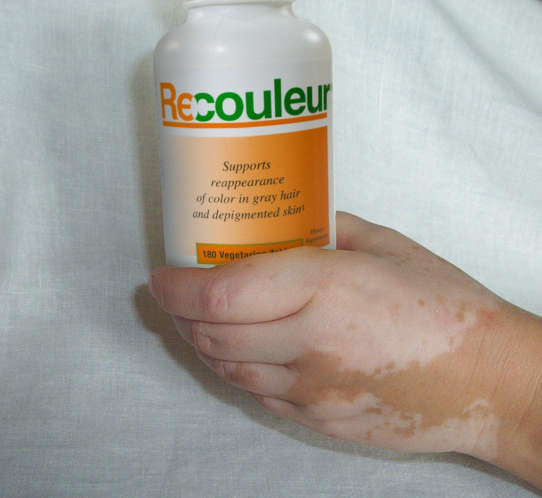 Recouleur Vitiligo Vitamin and Mineral Supplement Tablets 180 Count