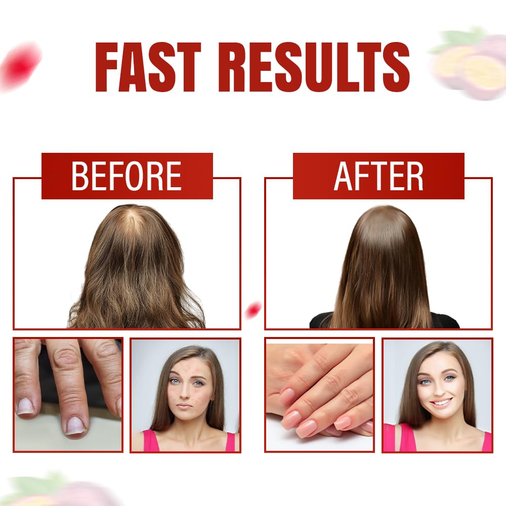 Aurisova Everyday Glow Biotin 6000mcg & Marine Collagen Gummies, 60 Count
