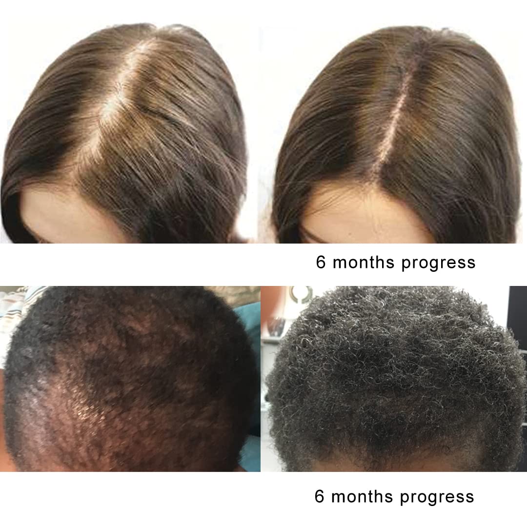 KERATIN RESEARCH Saw Palmetto Capsule 60 Capsules