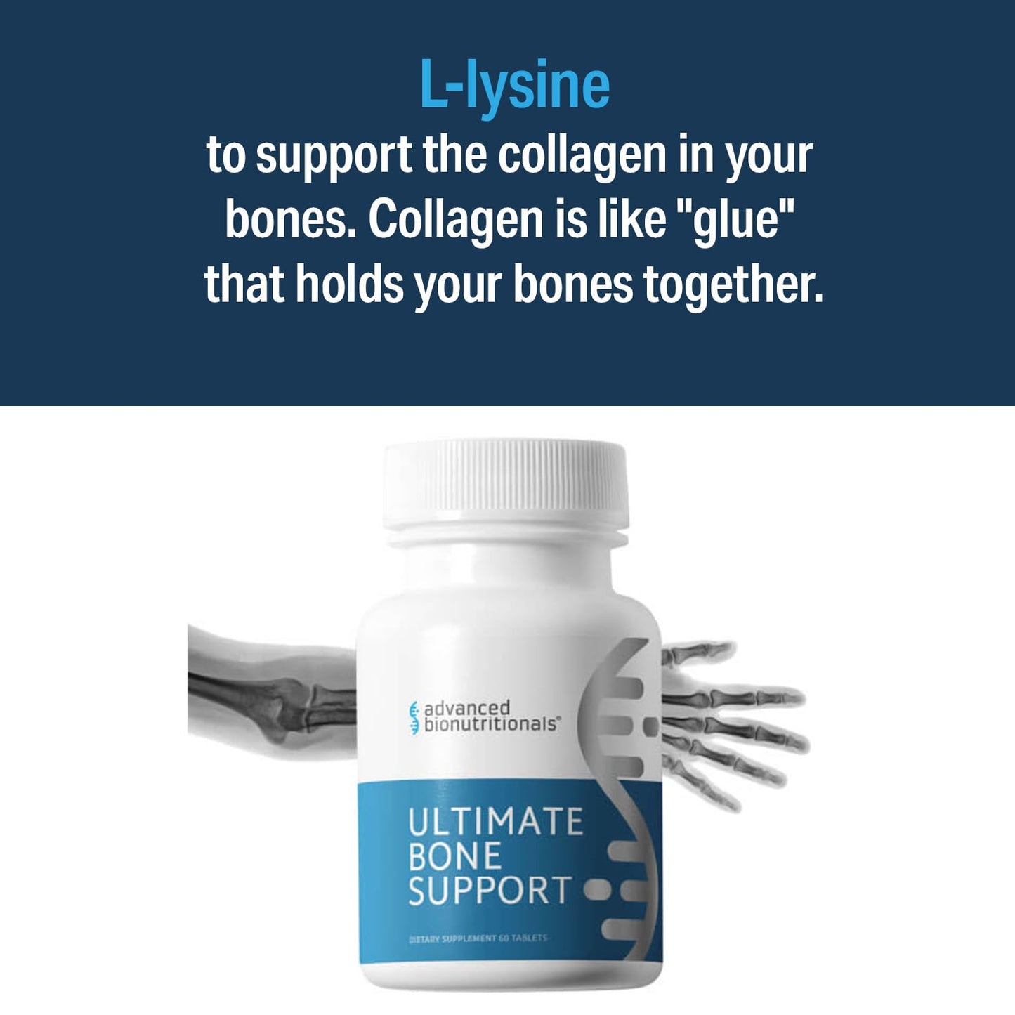 Advanced Bionutritionals Ultimate Bone Support Supplement Tablets 60