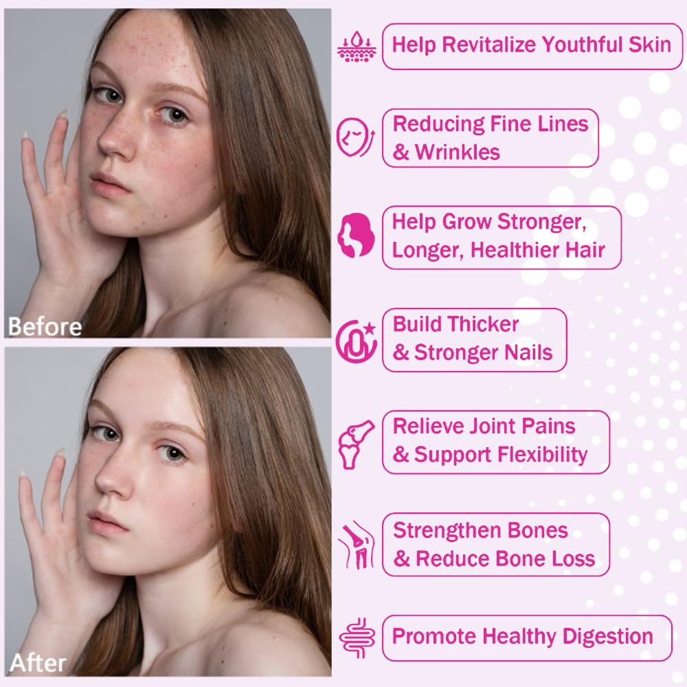 NutraNourish Multi Collagen Peptides Powder 32 Servings