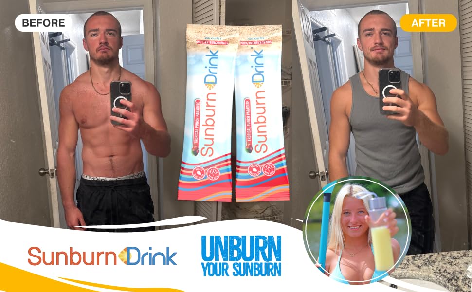 Sunburn Drink Sunburn Relief Drink Tropical Punch Paradise Powder Pack of 20