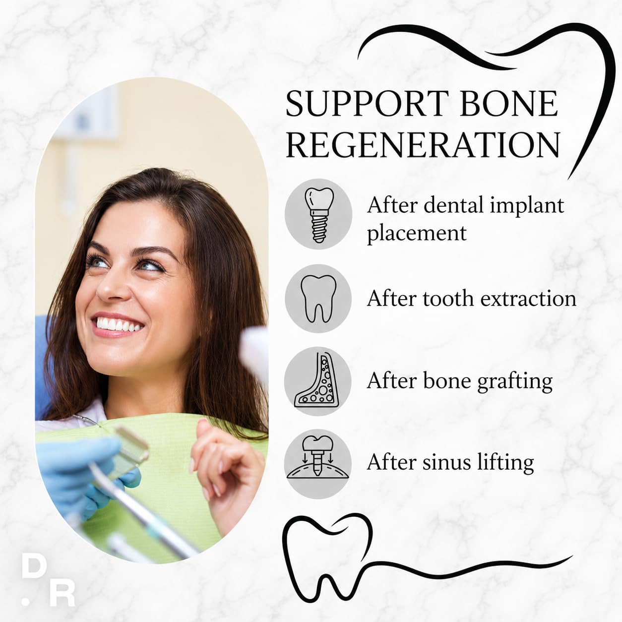 Dental Rituals Implant Care – Bone Regeneration Supplement for Dental Implants, 30 Tablets