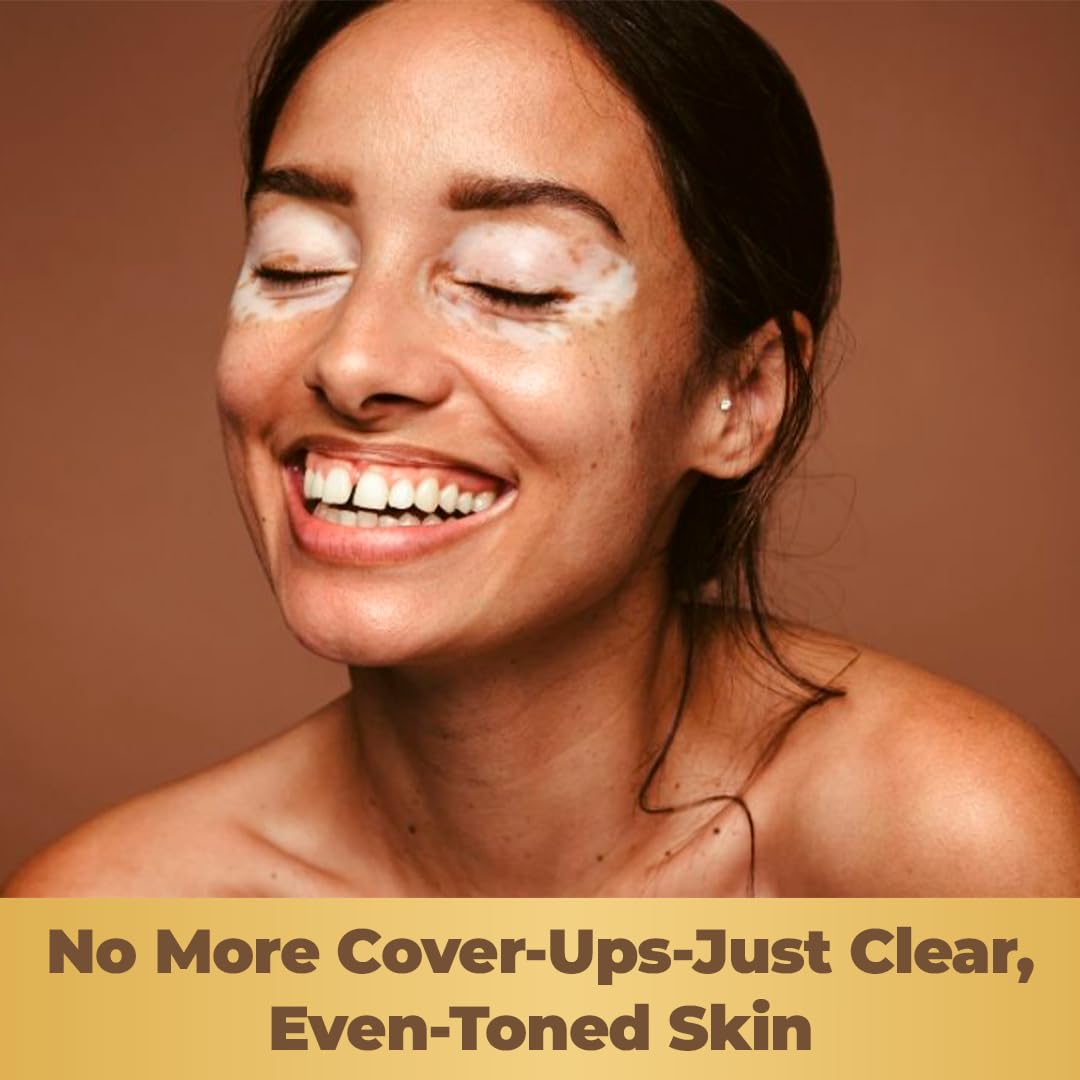 Aura Vitamins Dermawonder Vitiligo Capsules 60 Count
