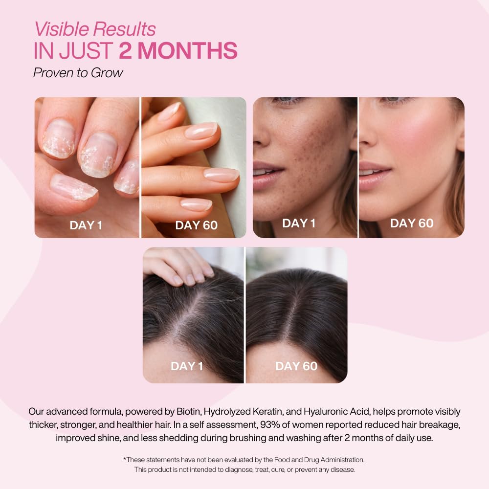 V&V Beauty Hair Growth Vitamin for Women - Biotin, Keratin & Hyaluronic Acid, 60 Capsules