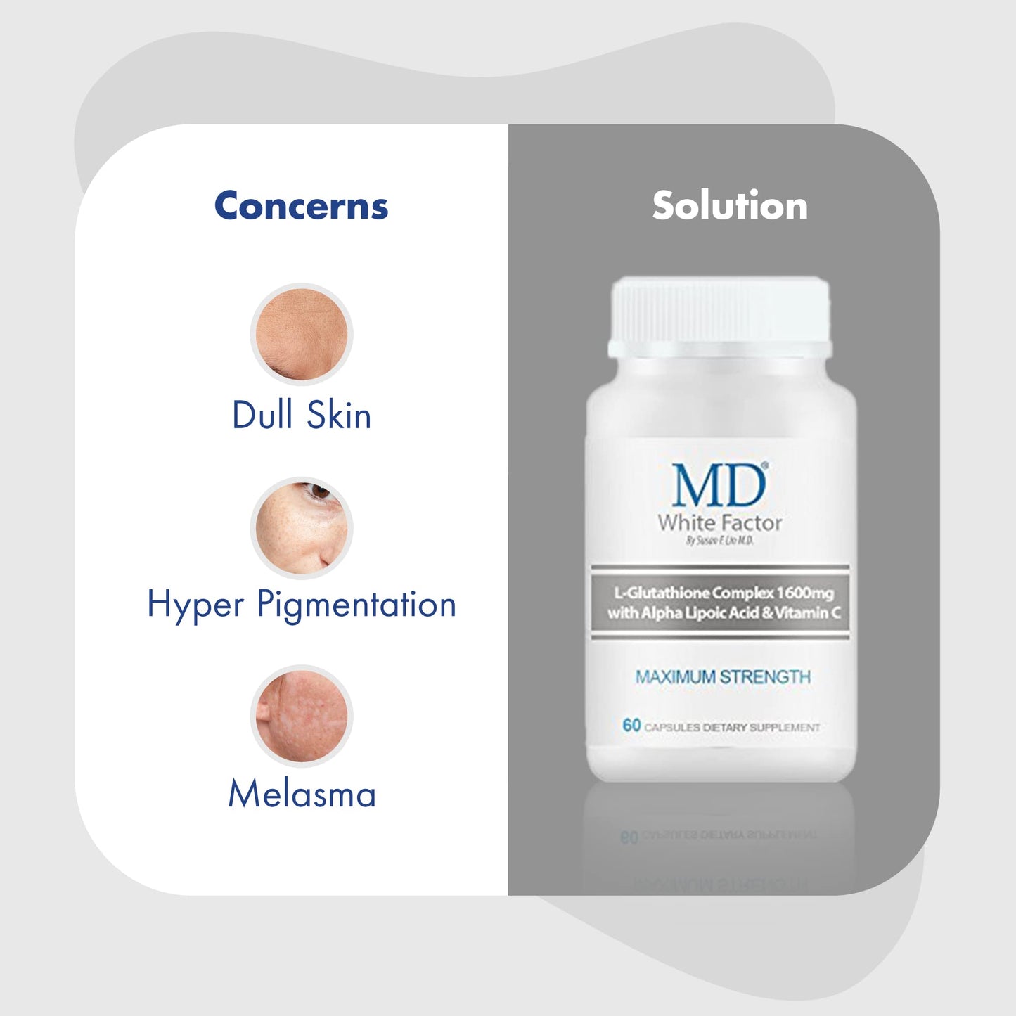 MD White Factor Glutathione Supplement with Effective Antioxidants, Vitamin C & Lipoic Acid Capsules, 60 Count
