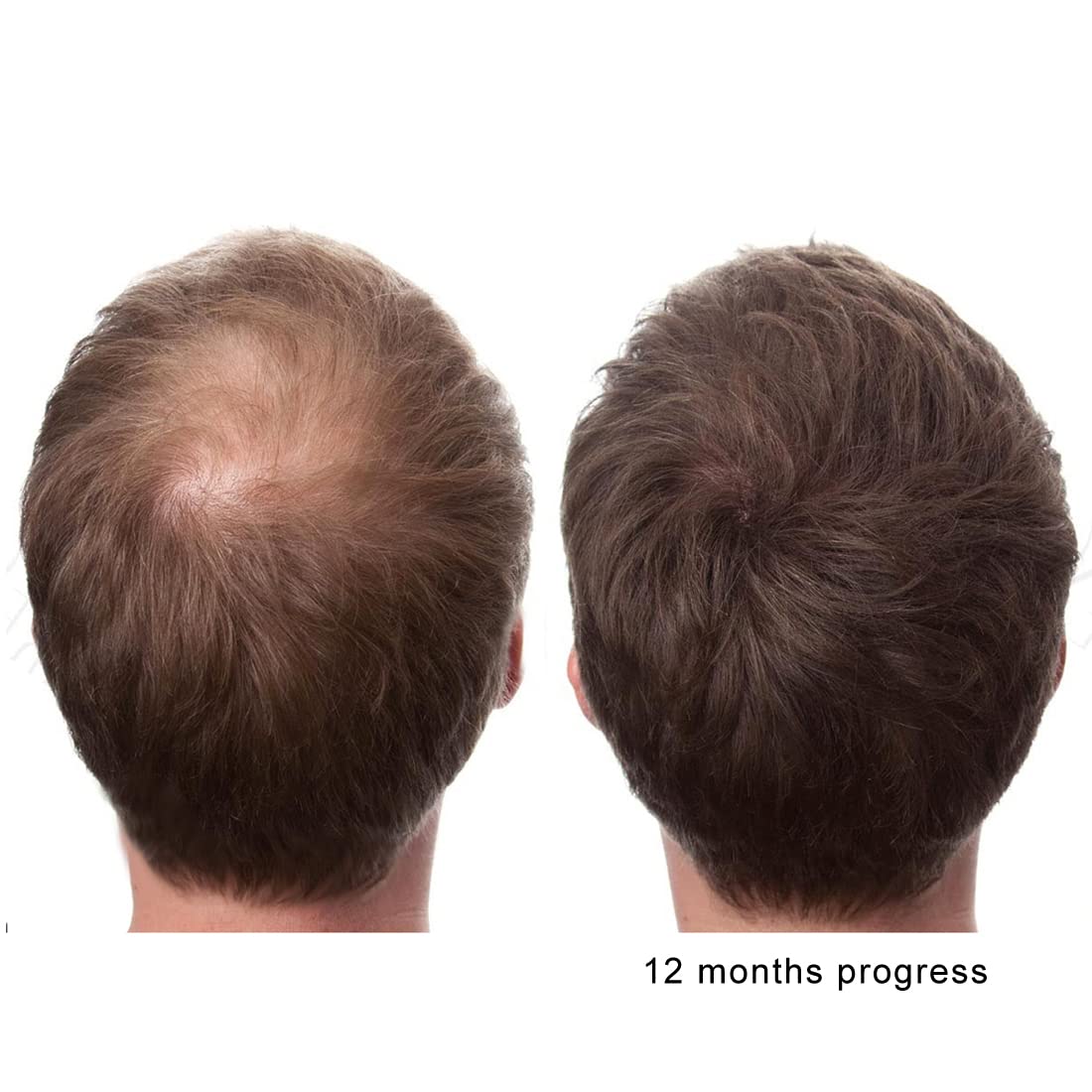 KERATIN RESEARCH Saw Palmetto Capsule 60 Capsules