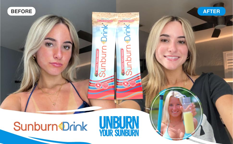 Sunburn Drink Sunburn Relief Drink Tropical Punch Paradise Powder Pack of 20