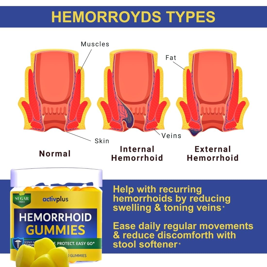 ACTIV PLUS Hemorrhoid Treatment to Reduce Re-occurrences & Easier Regularity with Stool Softener, 60 Gummies