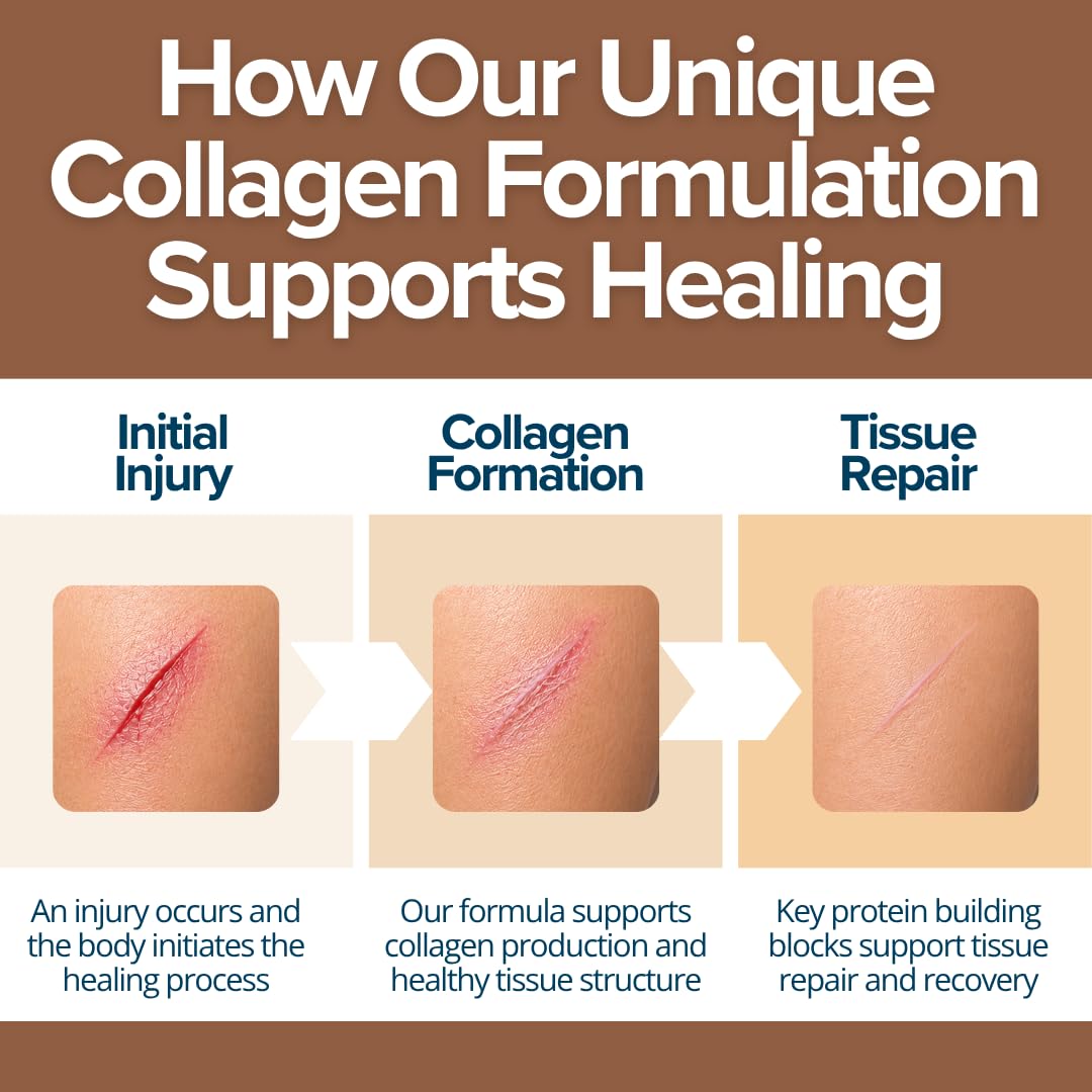 WOUND CAREPLUS Wound Collagen Powder for Wound Healing Support & Post-Surgery Recovery Chocolate 19.7534