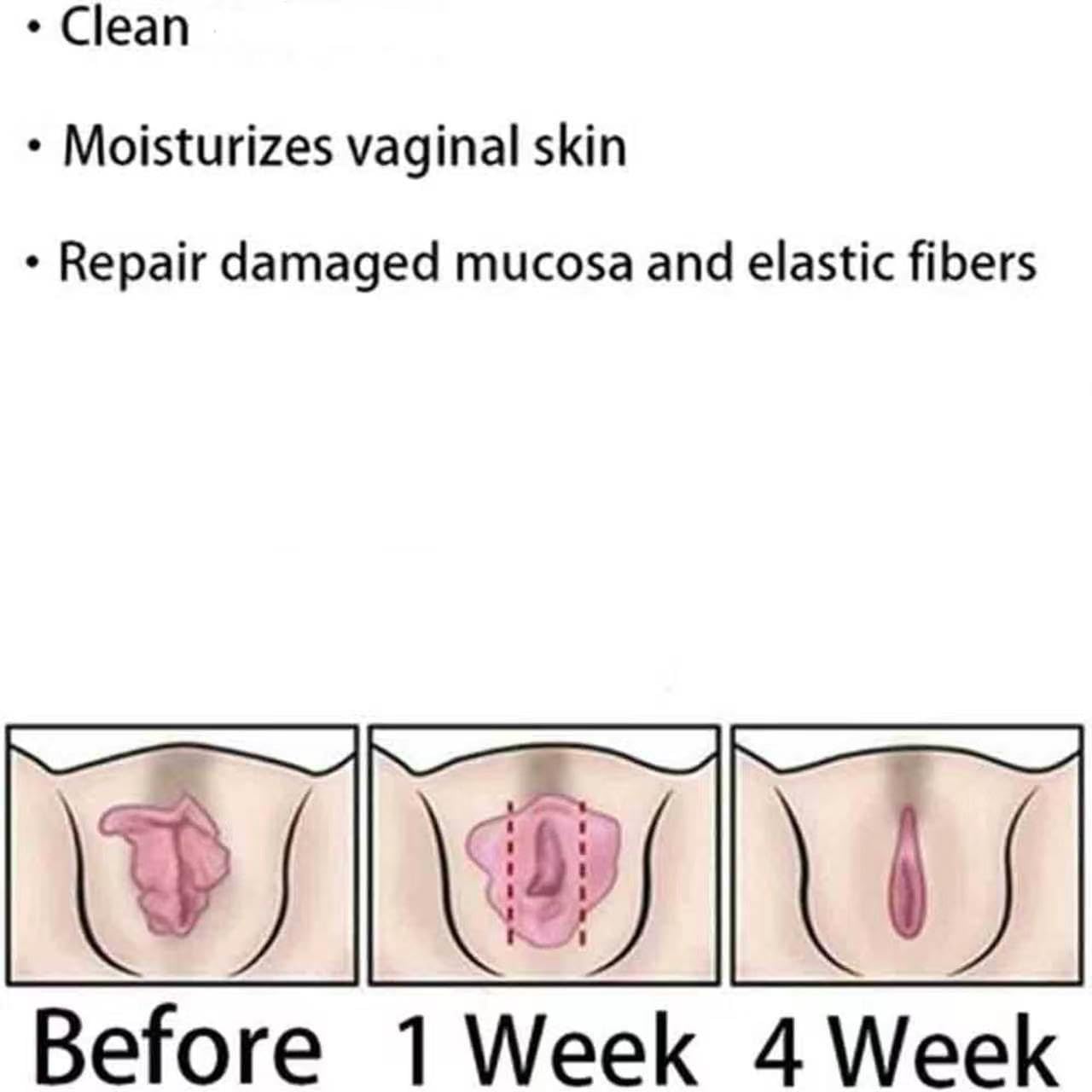 Weabet Instant Capsules Firming Repair & Pink and Tender Natural Stay Clear & Fresh, 11 Capsules