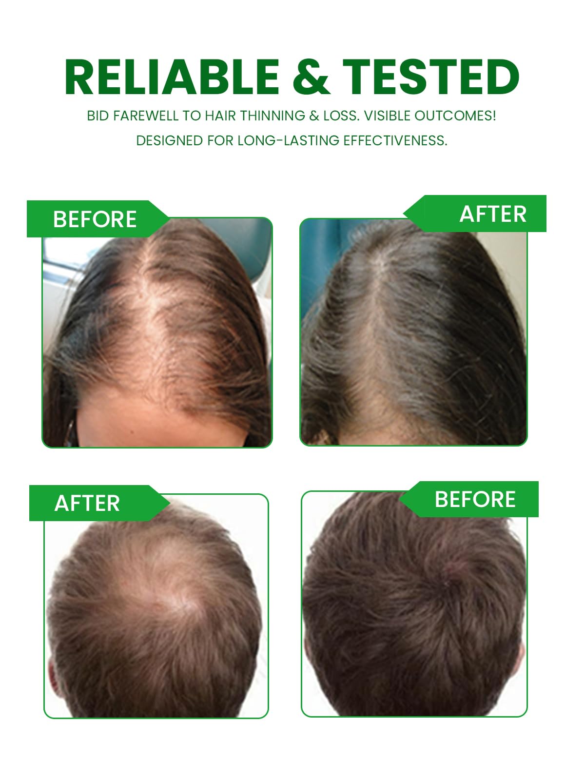 MANNACAN NATURALS Hair Growth Vitamins Capsules, 60 Capsules