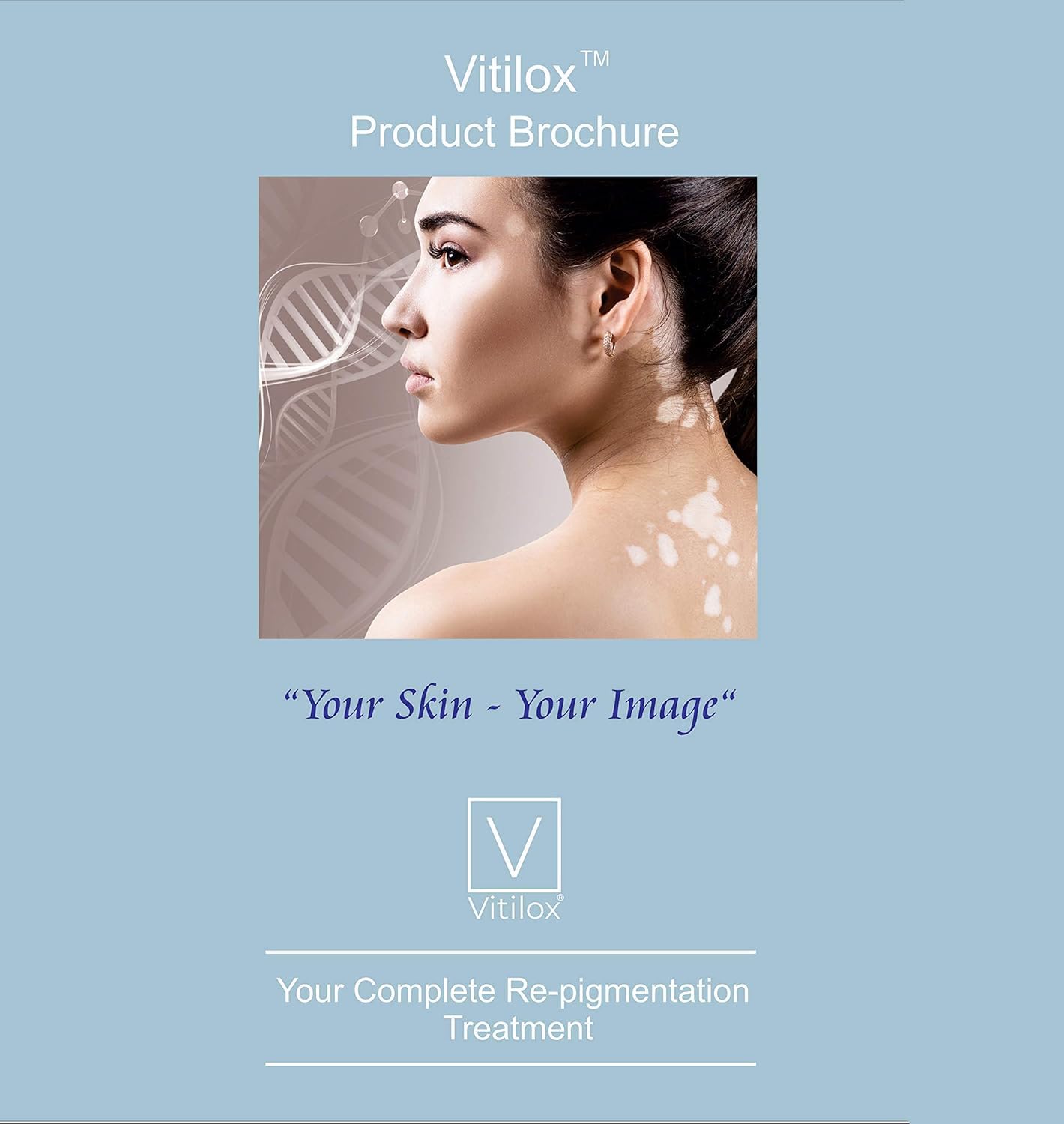 Vitilox Vitiligo T-Cell-V Immune Therapy Capsules, 120 Capsules