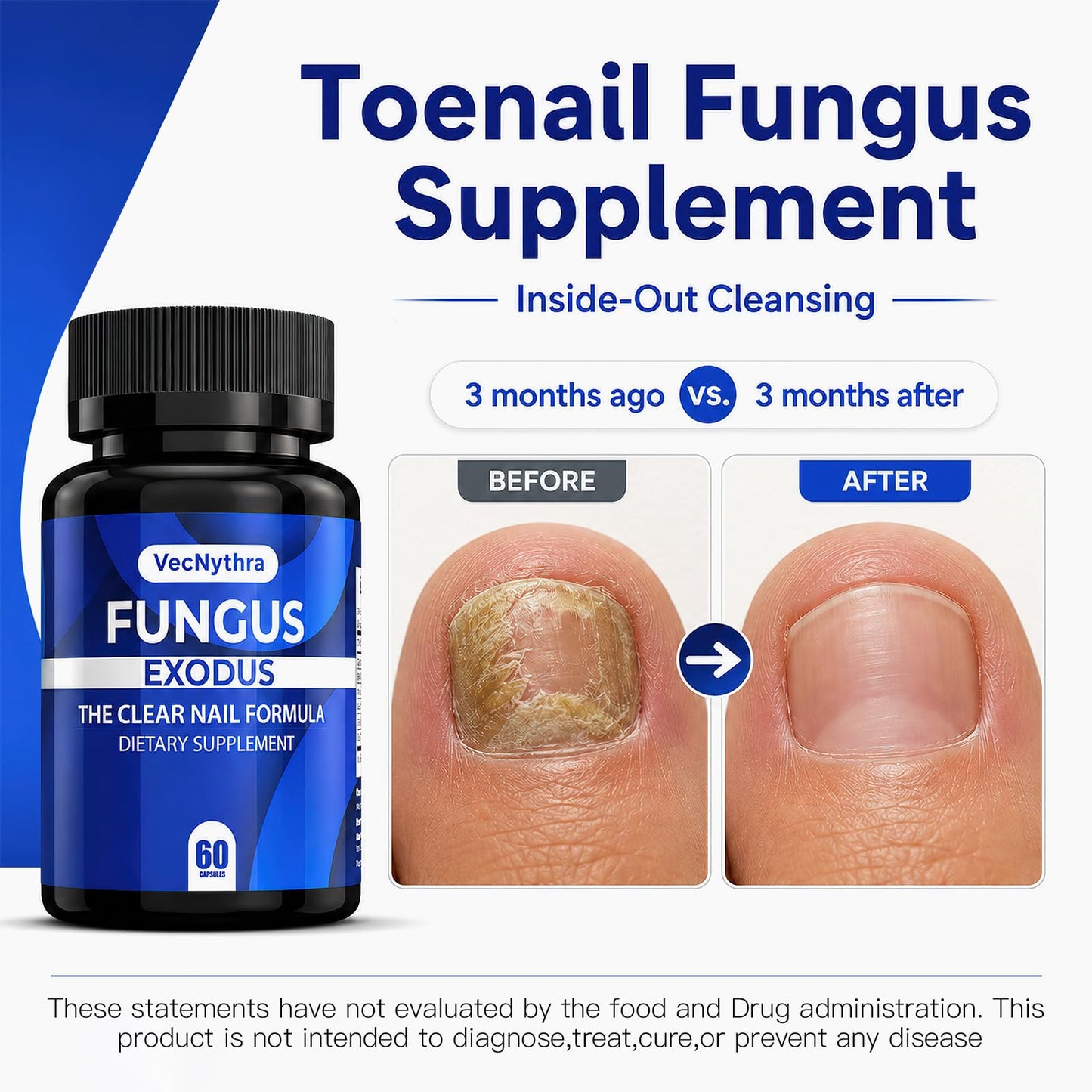 Jitesy Fungus Exodus - Botanical Support for Clear Nails - Plant-Based Dietary Supplement, 60 Capsules