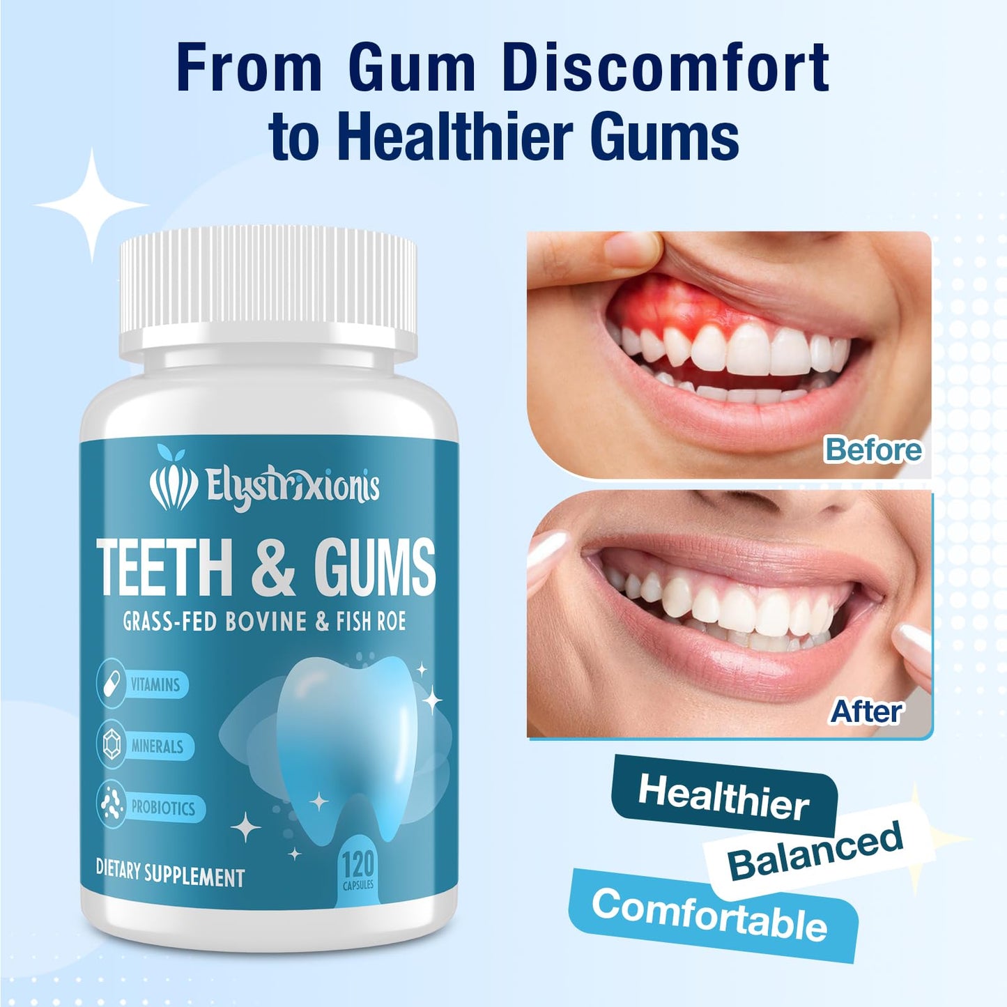 Elystrixionis Gum Restore Gum Repair for Receding Gums – Probiotic Oral Health Formula Capsule, 120 Capsules