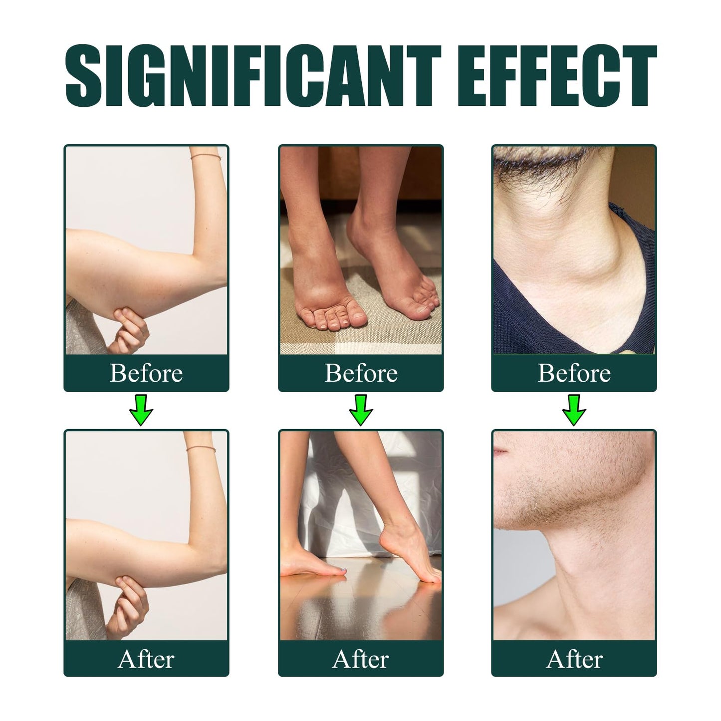 Slifthistle Lymphatic Drainage Drops 1 Capsule