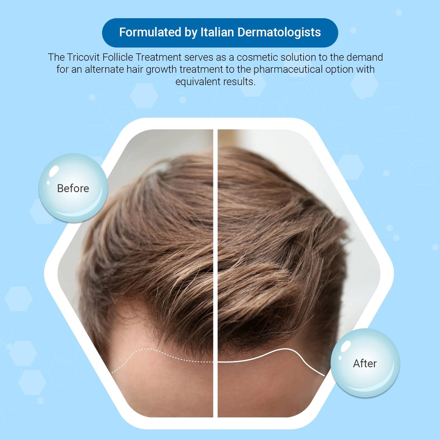 Tricovit Hair Growth Supplement - Nail & Hair Health Vitamins with Amino Acids, Minerals & Antioxidants, 60 Tablets