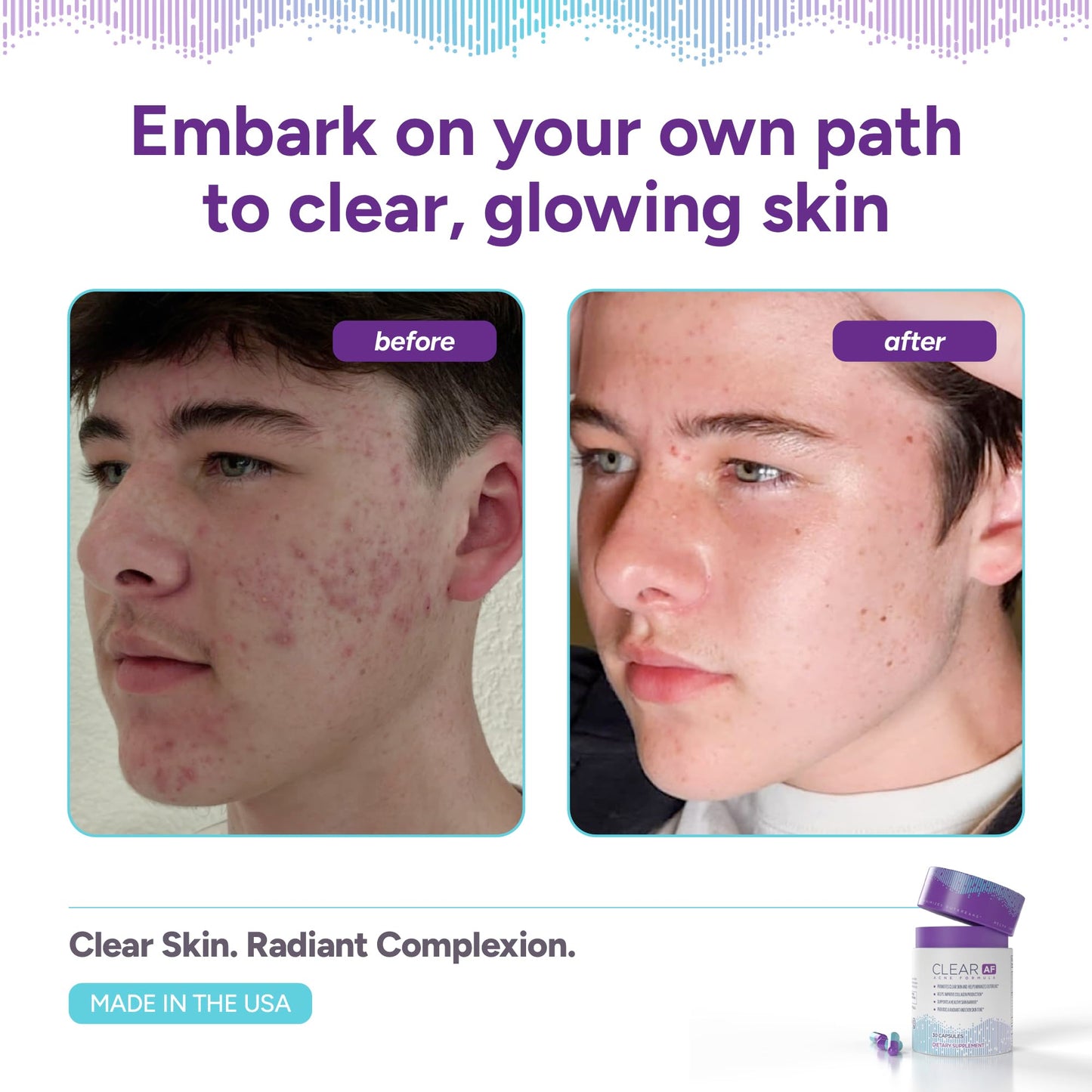 Clear AF Clear Skin Supplement Capsule, 30 Count