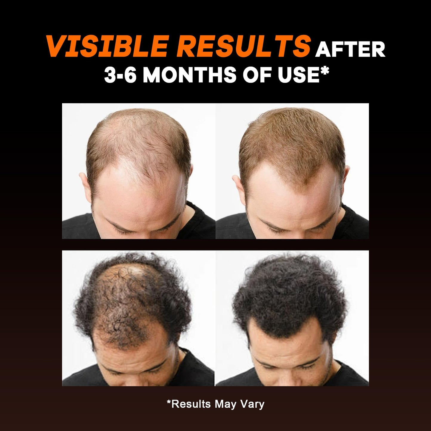 BOTANFOL DHT Blocker for Men Hair Growth Capsule, 60 Capsules