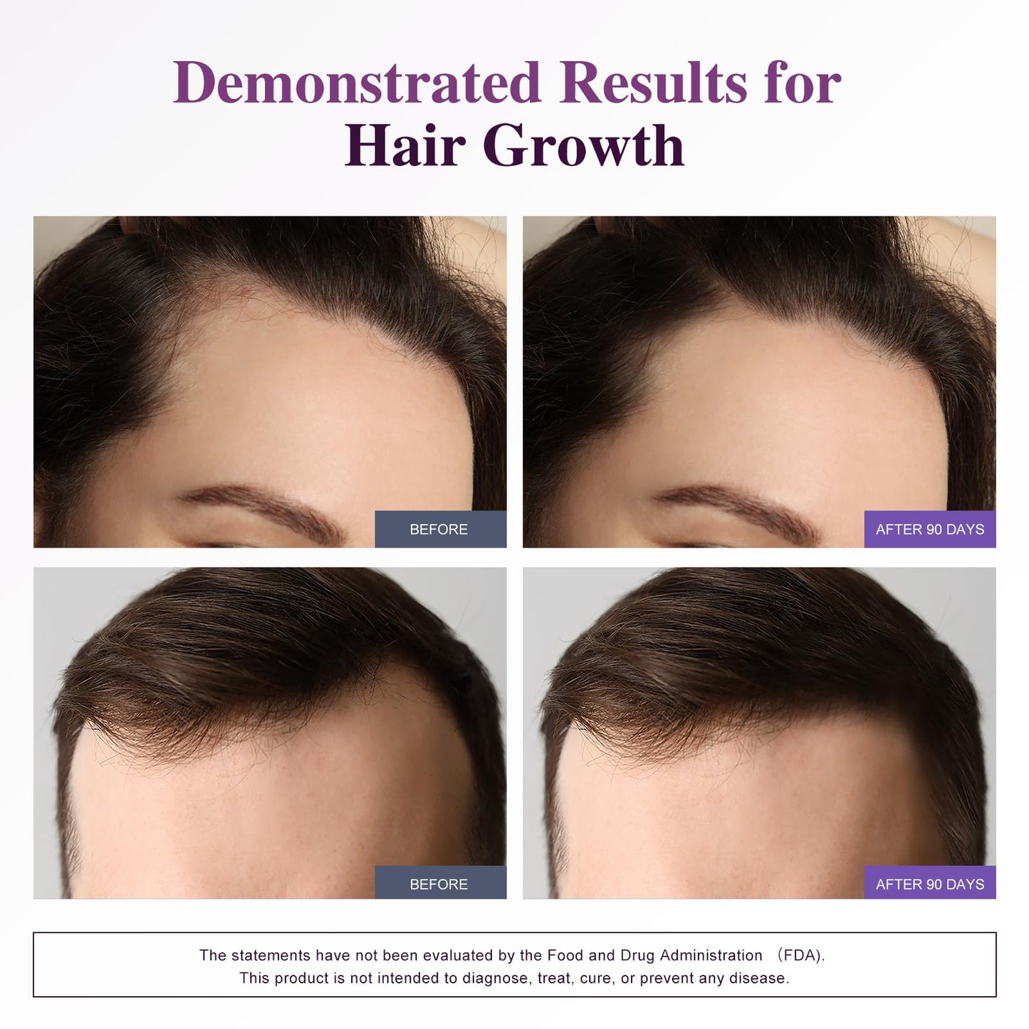 Bevalence Biotin 10,000 mcg Hair Growth Support Capsules, 120 Count