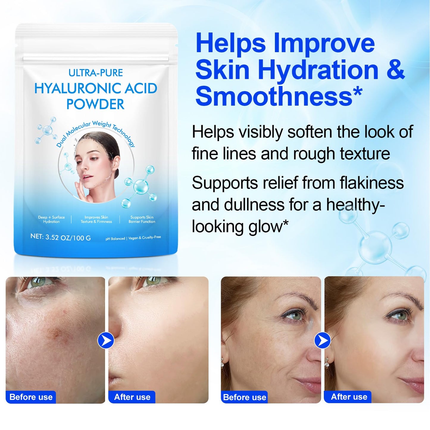 NBTREKTIE Hyaluronic Acid Powder for Skin, 3.52 oz