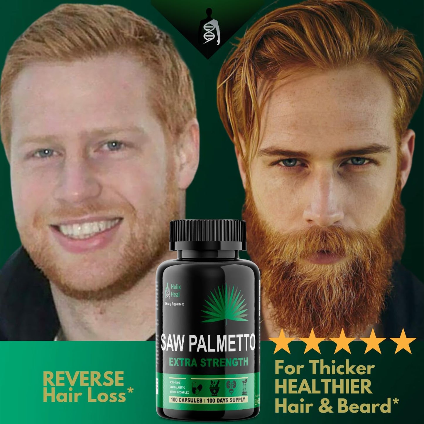 Helix Heal Saw Palmetto Capsules 100 Count