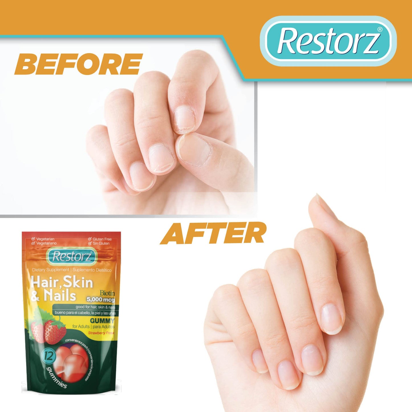 Restorz Biotin Gummy Vitamins for Hair, Skin, and Nails, Strawberry Flavor, 12-Pack