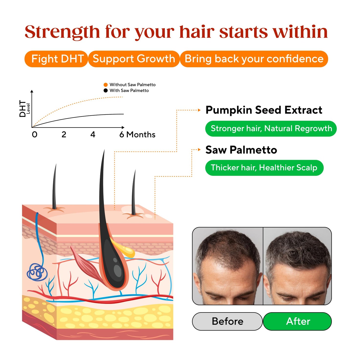 Nutrient Byte Saw Palmetto Gummies for Hair Growth & Hormone Balance 1 Count