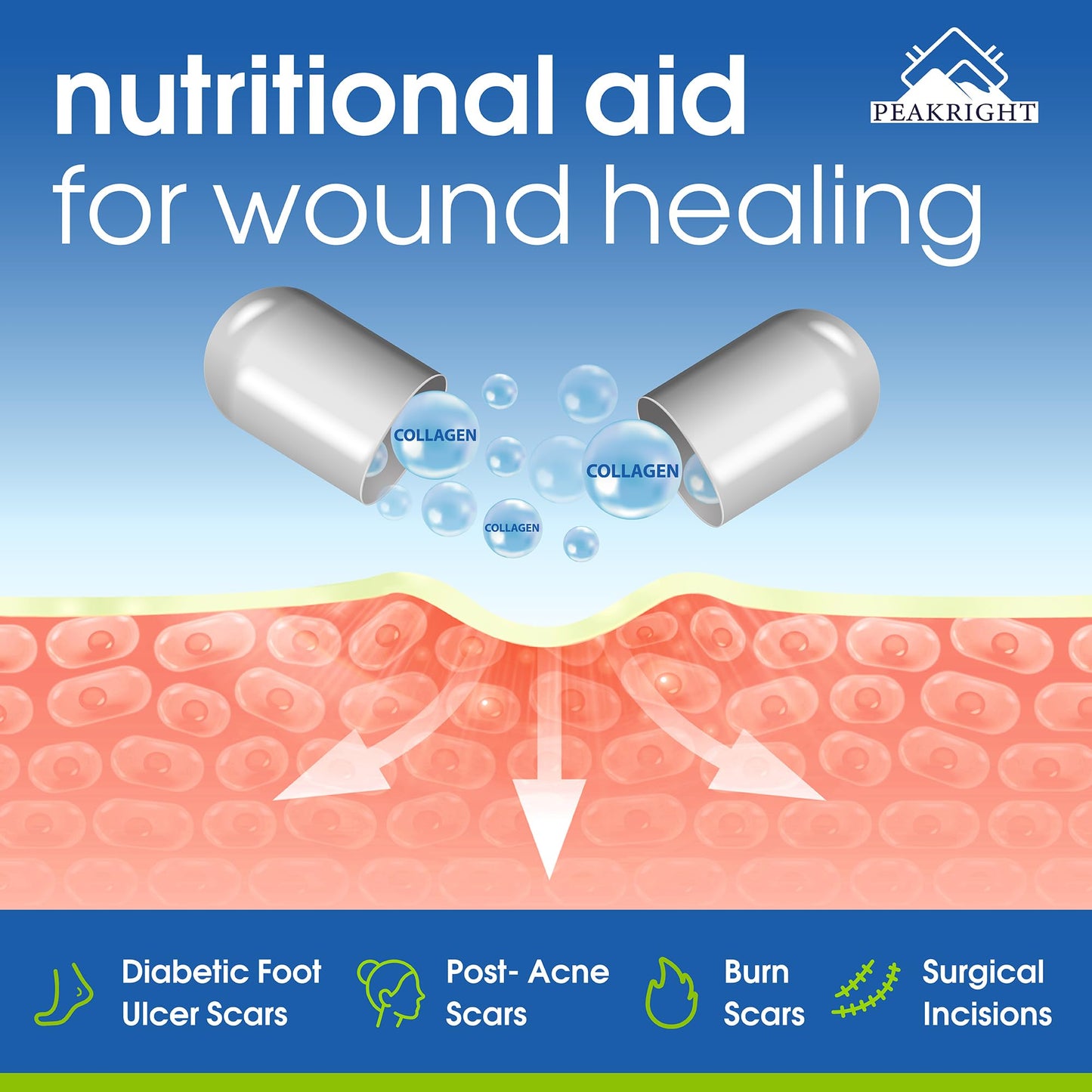 Peakright Wound Healing Supplement Collagen Complex with Enzymes for Wound Support, Pre & Post Surgery Recovery - Capsules, 60 Count