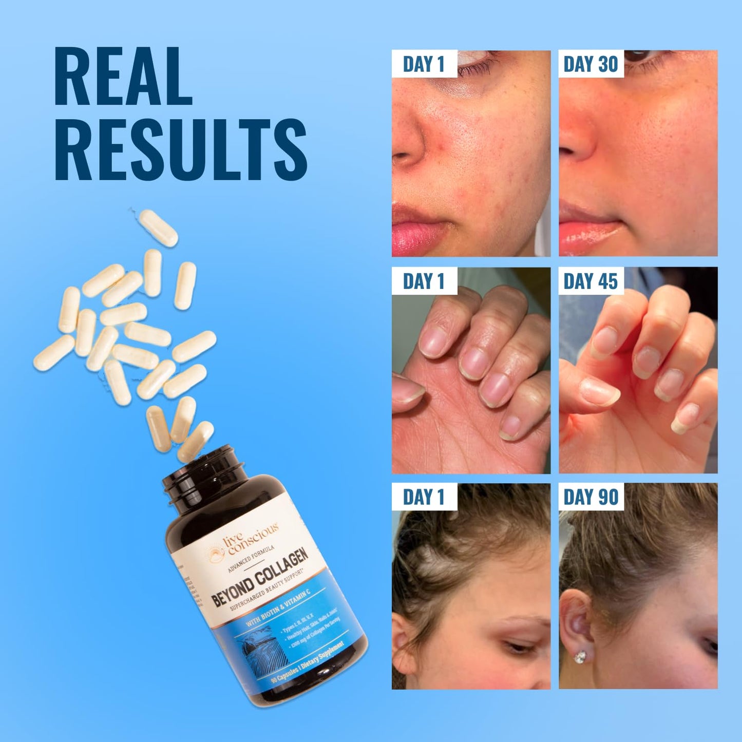 Live Conscious Beyond Collagen Multi Collagen Capsules - Types I, II, III, V & X - Hydrolyzed Blend with Biotin & Vitamin C for Hair, Skin, Nails, 90 Capsules