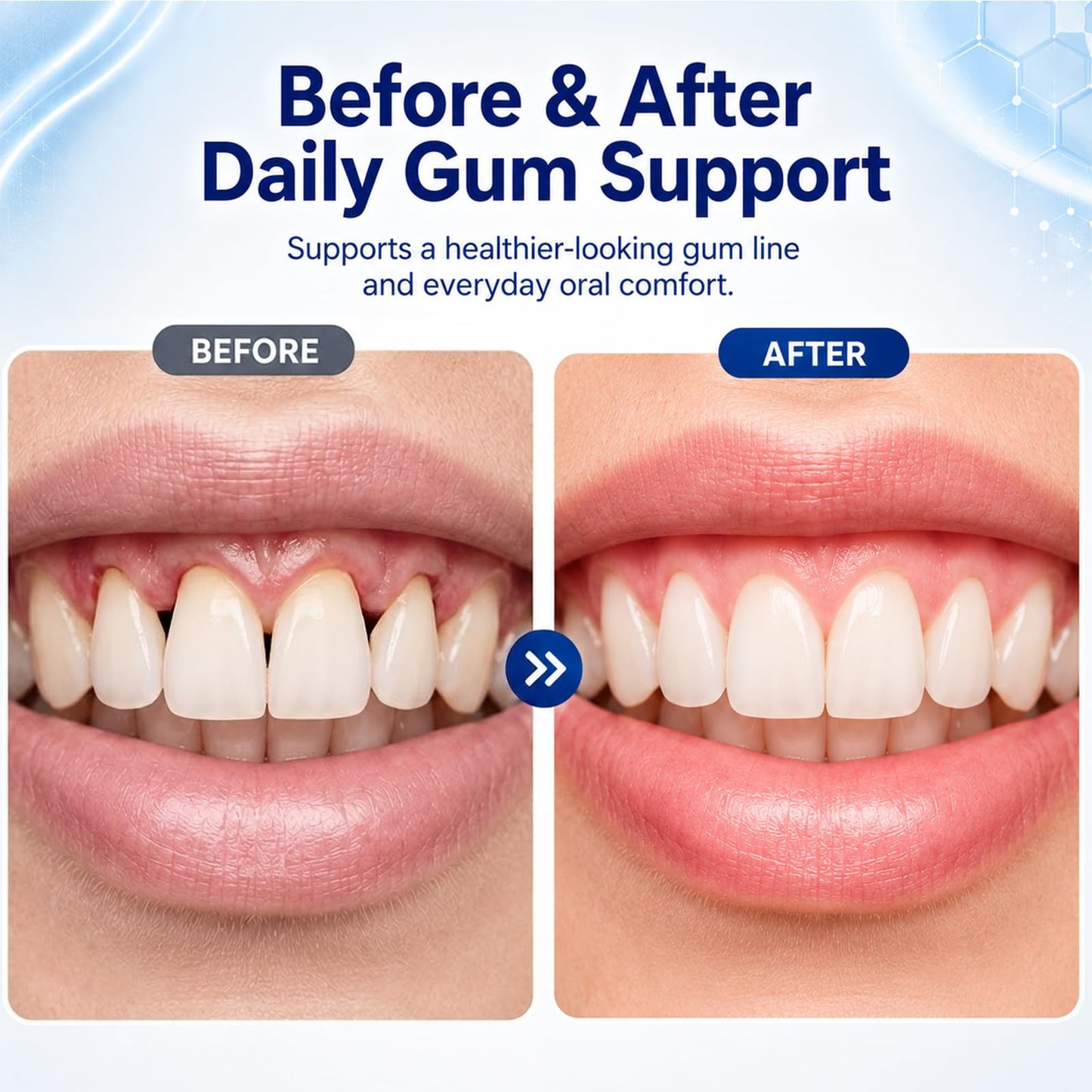Nurevion Gum Restore Capsule 120 Capsules