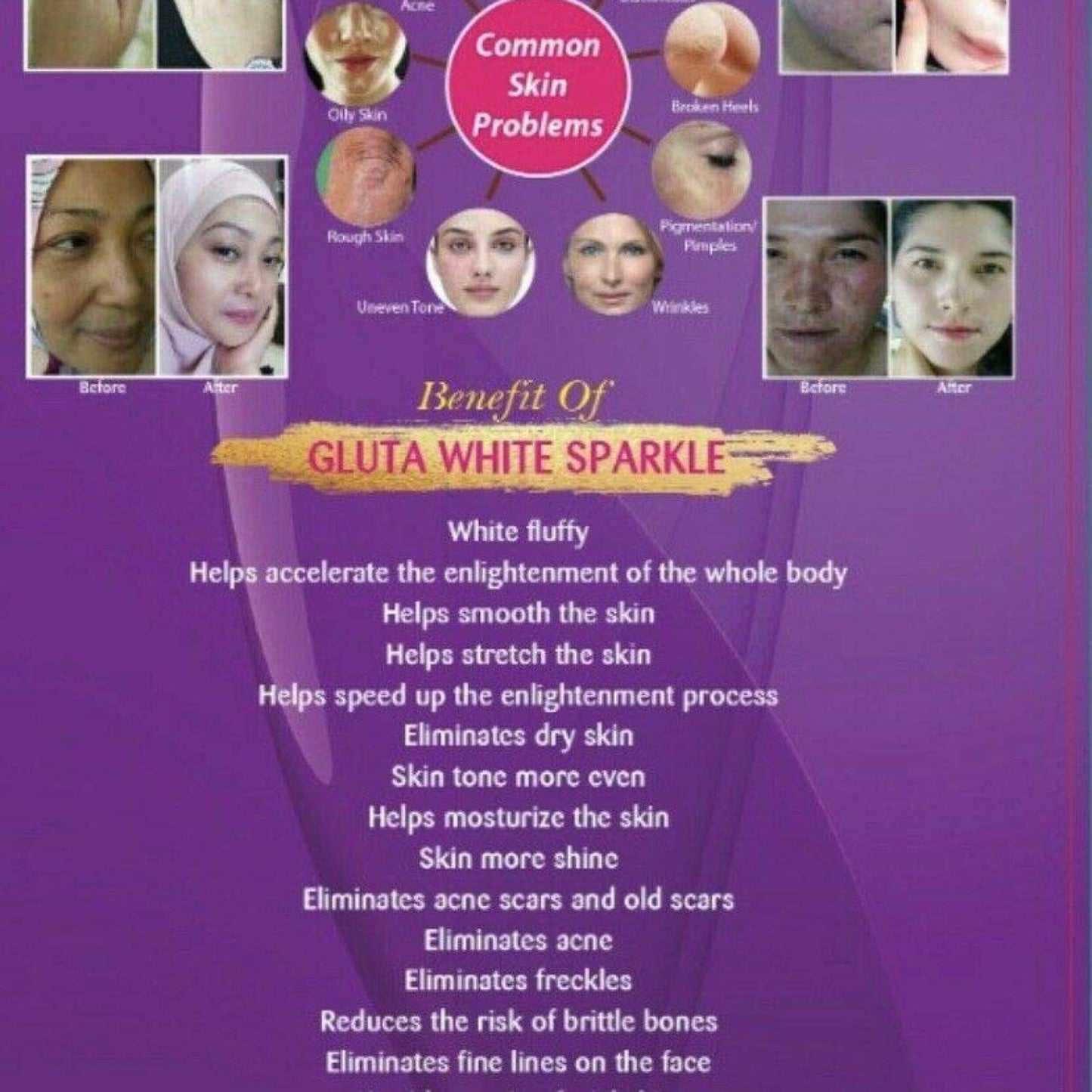 Supream gluta GLUTA White Sparkle L-GLUTATHIONE Plus Best 2X Skin WHITENING Supplement 750G Powder 72 Count