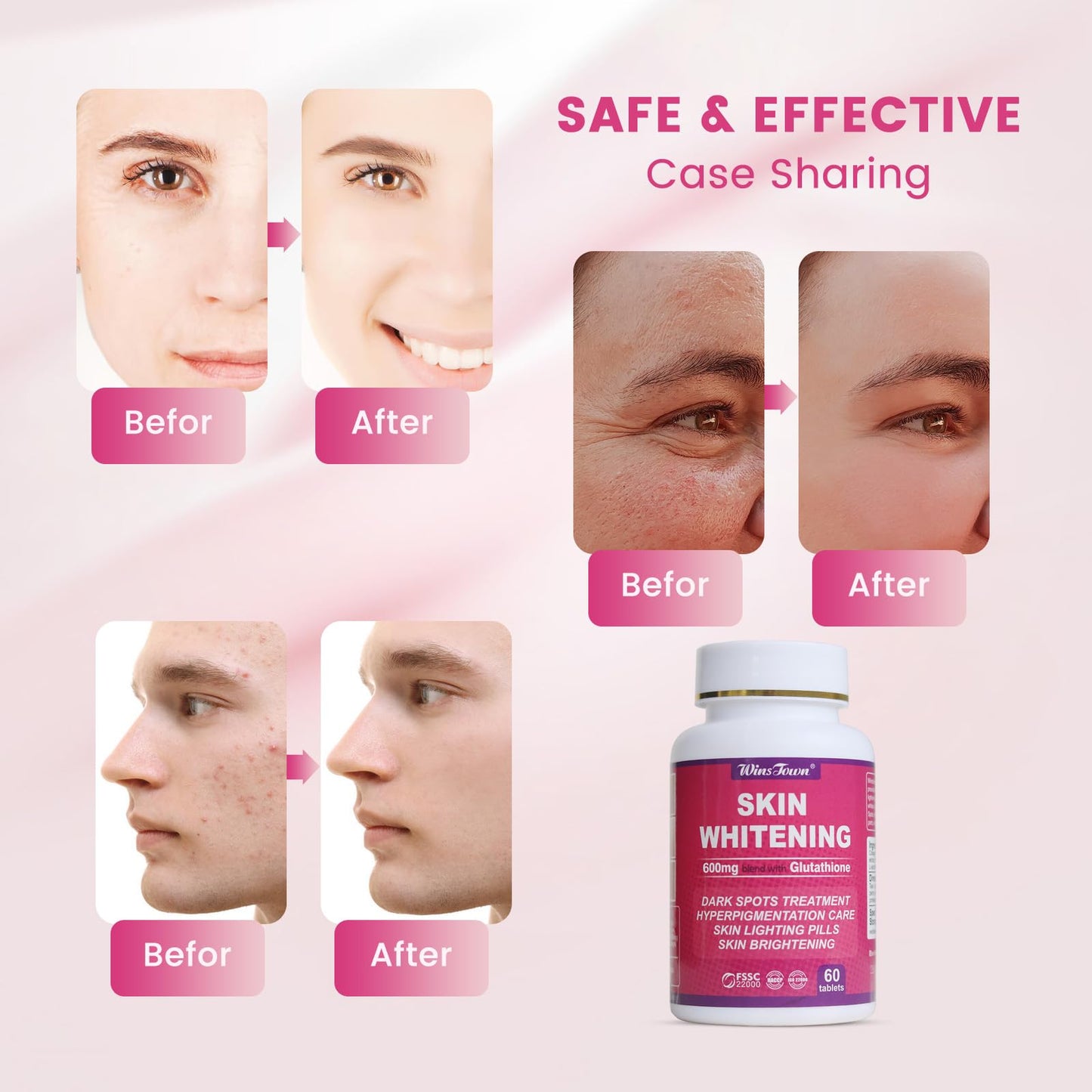 AIHIYO Skin Whitening Pill 600mg Glutathione Supplement for Dark Spots, Melasma & Acne Scar Remover, 60 Tablets