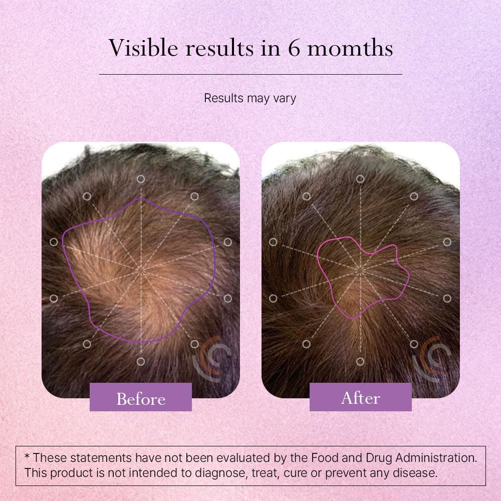 Omvi Hair Growth Supplement with Biotin 20,000mcg, Collagen, Keratin, Vitamin A, C, D3 & B12, Stronger Hair, Skin and Nails, Non-GMO, Gluten Free, 120 Capsules