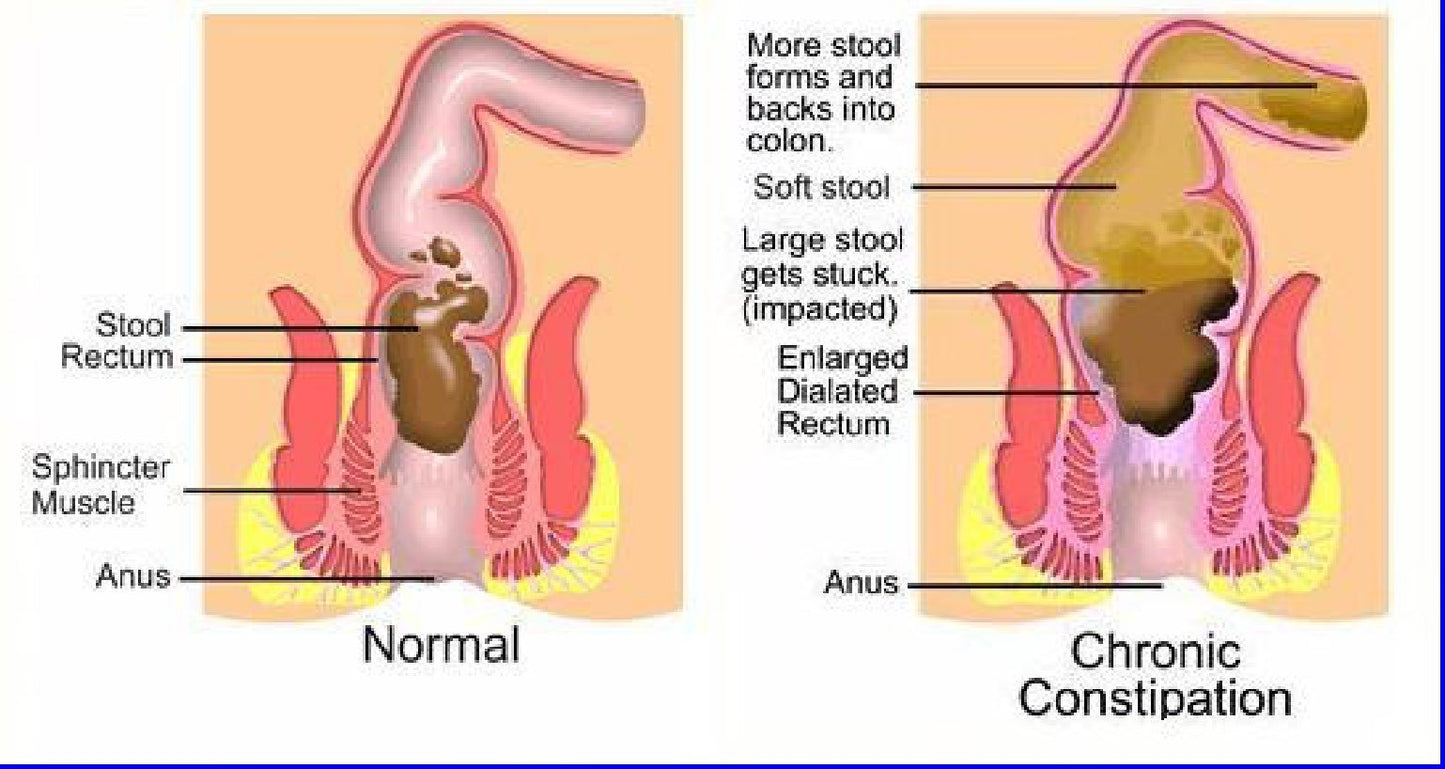 The One Minute Miracle Miracle Oxy-Colon Cleanse Capsule 1 Count