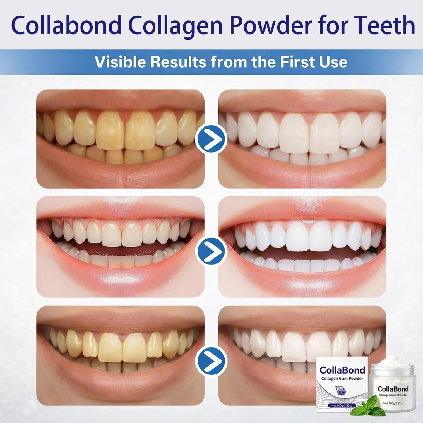 COLLABOND Collagen Tooth Powder for Gums and Teeth, Powder, 3.52 oz