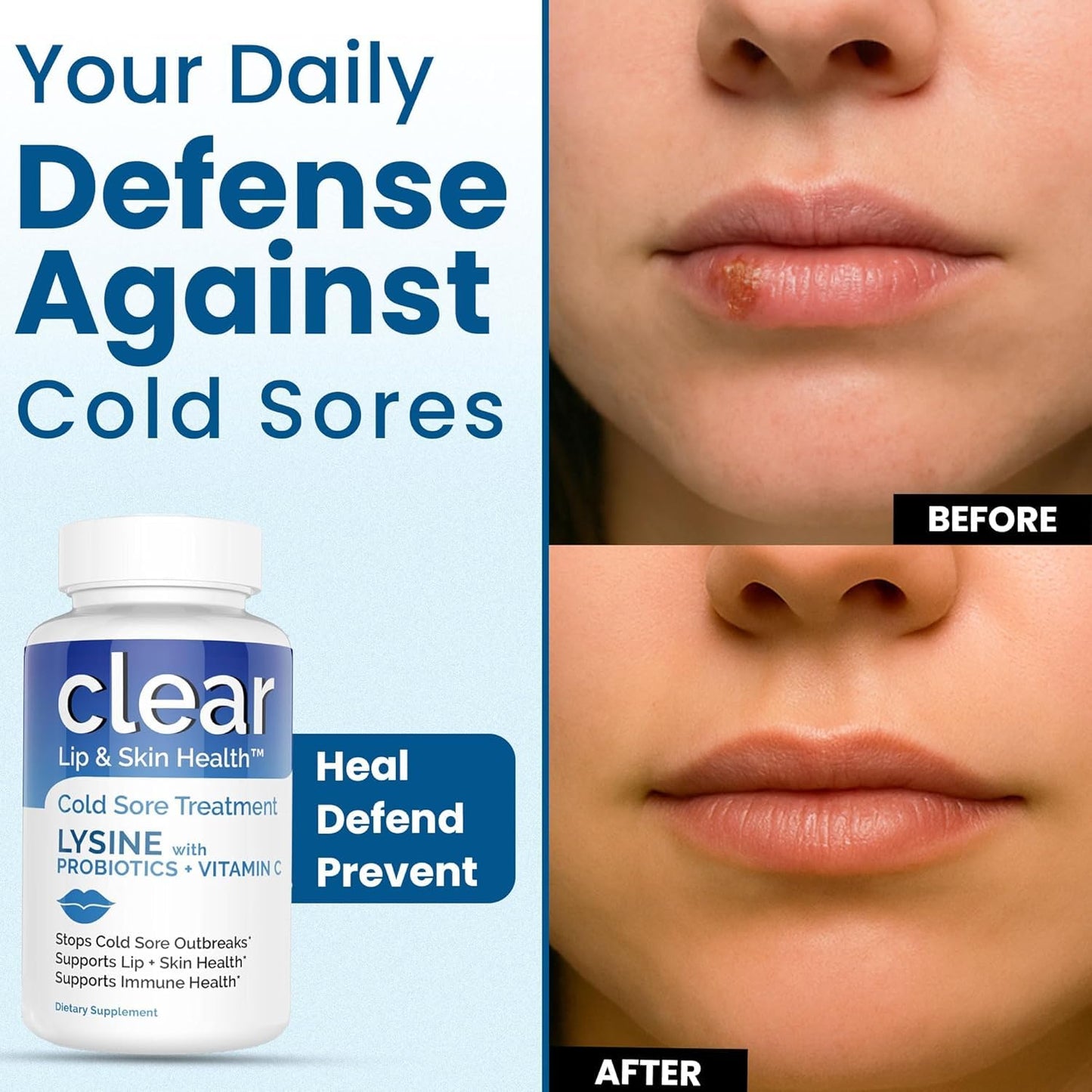 Clear Probiotics Lysine Cold Sore Treatment for Lips with Pre-Probiotics & Vitamin C Capsules 180